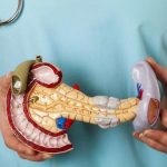 Cancro al pancreas, nuovo farmaco può aumentare tempo di sopravvivenza