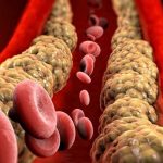 Colesterolo, sviluppato farmaco che colpisce la lipoproteina (a)