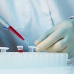Hiv, guarito con trapianto di staminali il primo paziente senza mutazione CCR5-delta-32