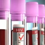 Hiv, niente contagio se la carica virale è bassa