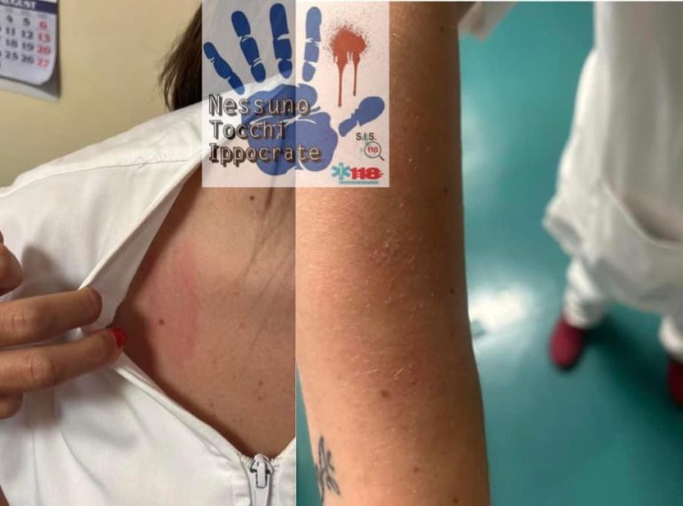 Infermiera presa a schiaffi da una paziente al pronto soccorso di Acerra