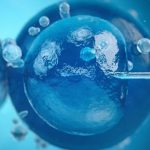 Tecniche di procreazione medicalmente assistita