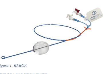 Il ruolo del REBOA nel trattamento delle emorragie non comprimibili