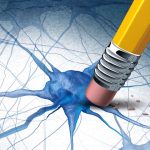 Alzheimer, scoperto meccanismo che causa morte neuronale
