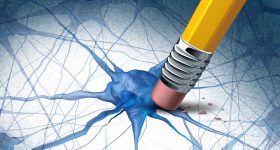 Alzheimer, scoperto meccanismo che causa morte neuronale