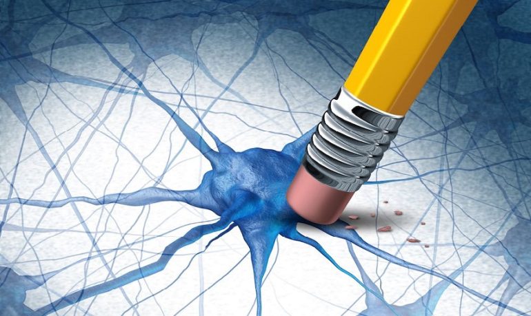Alzheimer, scoperto meccanismo che causa morte neuronale