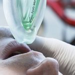 Gestione avanzata delle vie aeree nell’Emergenza Extraospedaliera: i presidi Sovraglottici