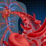 Infarto, effetto protettivo dei globuli rossi potenziato da dieta vegetale ricca di nitrati