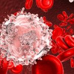 Leucemia, identificato collegamento tra infiammazione cronica e sviluppo della malattia