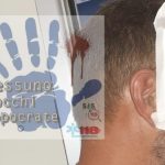 Napoli, infermiere malmenato mentre si protesta contro le aggressioni al personale sanitario