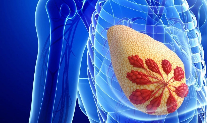 Tumore al seno: quando le microcalcificazioni sono un segnale d'allarme