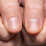 Unghie delle mani: i segnali d'allarme per l'infermiere