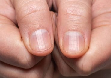 Unghie delle mani: i segnali d'allarme per l'infermiere