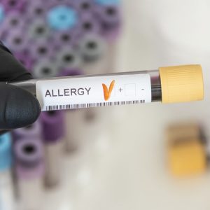 Allergie, per scovarle non basta più il test cutaneo: va scoperta nel sangue la molecola scatanente