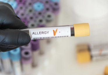 Allergie, per scovarle non basta più il test cutaneo: va scoperta nel sangue la molecola scatanente