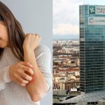 Giornata mondiale della psoriasi, a Milano il Pirellone illuminato