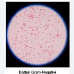 Ecm Fad gratuito per infermieri e professioni sanitarie sulle infezioni gravi da Gram negativi