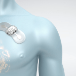 Il cuore in un cerotto: ecco l'elettrocardiogramma indossabile