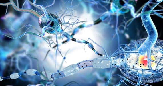 Sclerosi multipla secondaria progressiva: risultati positivi dal trapianto di cellule staminali