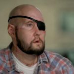 Trapianto di intero occhio umano eseguito a New York