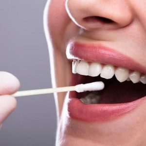 Tumori del cavo orale: un nuovo test salivare per la diagnosi precoce