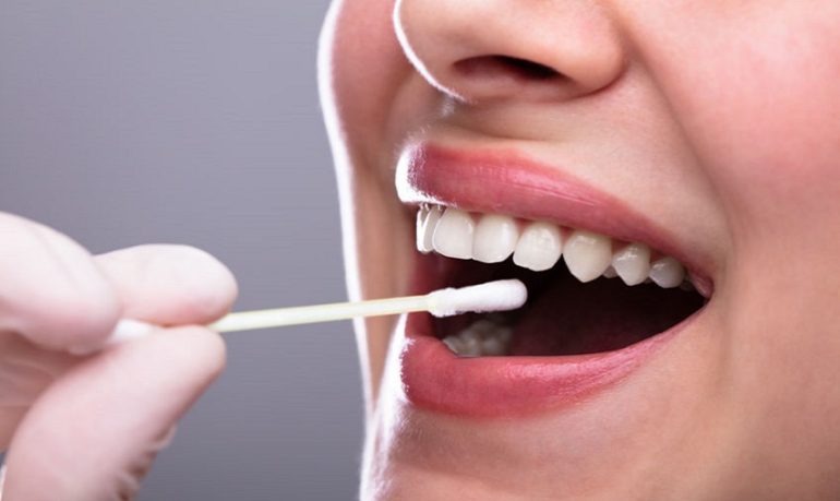 Tumori del cavo orale: un nuovo test salivare per la diagnosi precoce