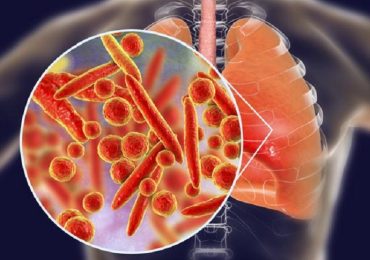 Polmoniti batteriche, Iss risponde a domande più frequenti su Mycoplasma pneumoniae
