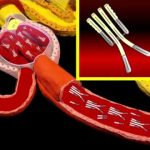 Proteine di Bence Jones: guida pratica all’esame