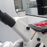 CAR-T, al Bambino Gesù trattati i primi tre pazienti con malattia autoimmune