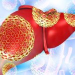 Epatite B cronica, potente molecola immunoterapica testata per la prima volta al San Raffaele
