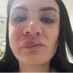 Infermiera trascinata per capelli e colpita con un pugno al volto: orrore nel Pronto Soccorso di Castellammare