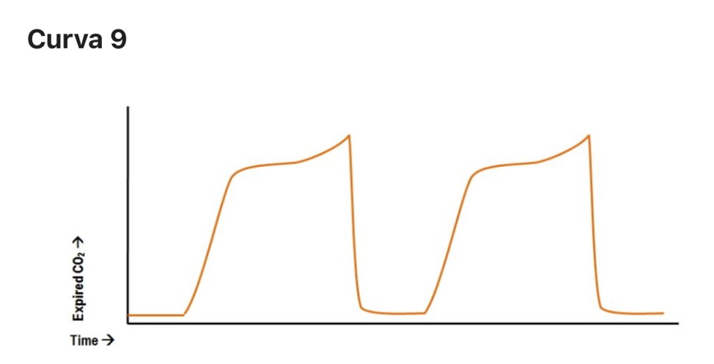 L’importanza del monitoraggio capnografico nella ventilazione meccanica: approfondimento tecnico 3