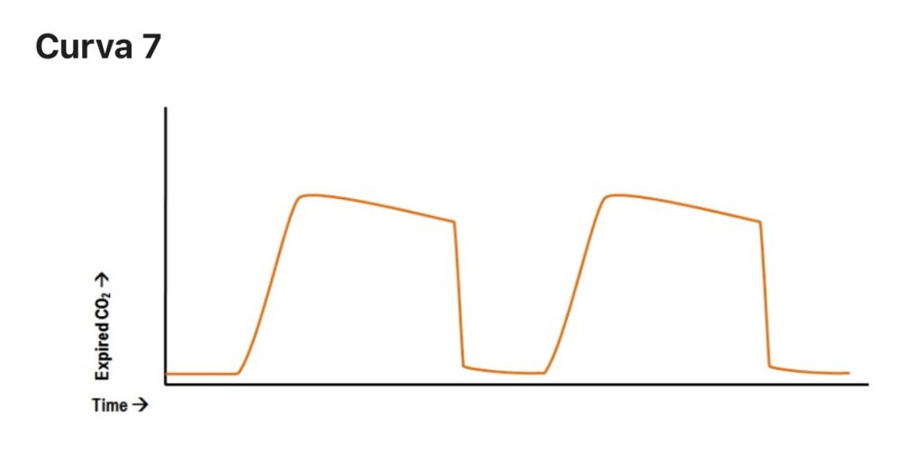 L’importanza del monitoraggio capnografico nella ventilazione meccanica: approfondimento tecnico 5