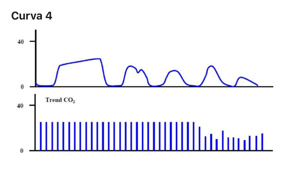 L’importanza del monitoraggio capnografico nella ventilazione meccanica: approfondimento tecnico 8