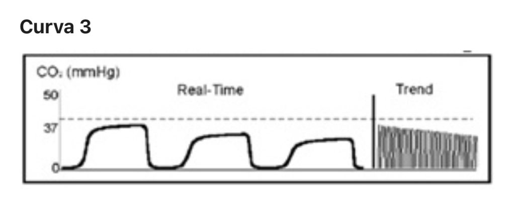 L’importanza del monitoraggio capnografico nella ventilazione meccanica: approfondimento tecnico 9