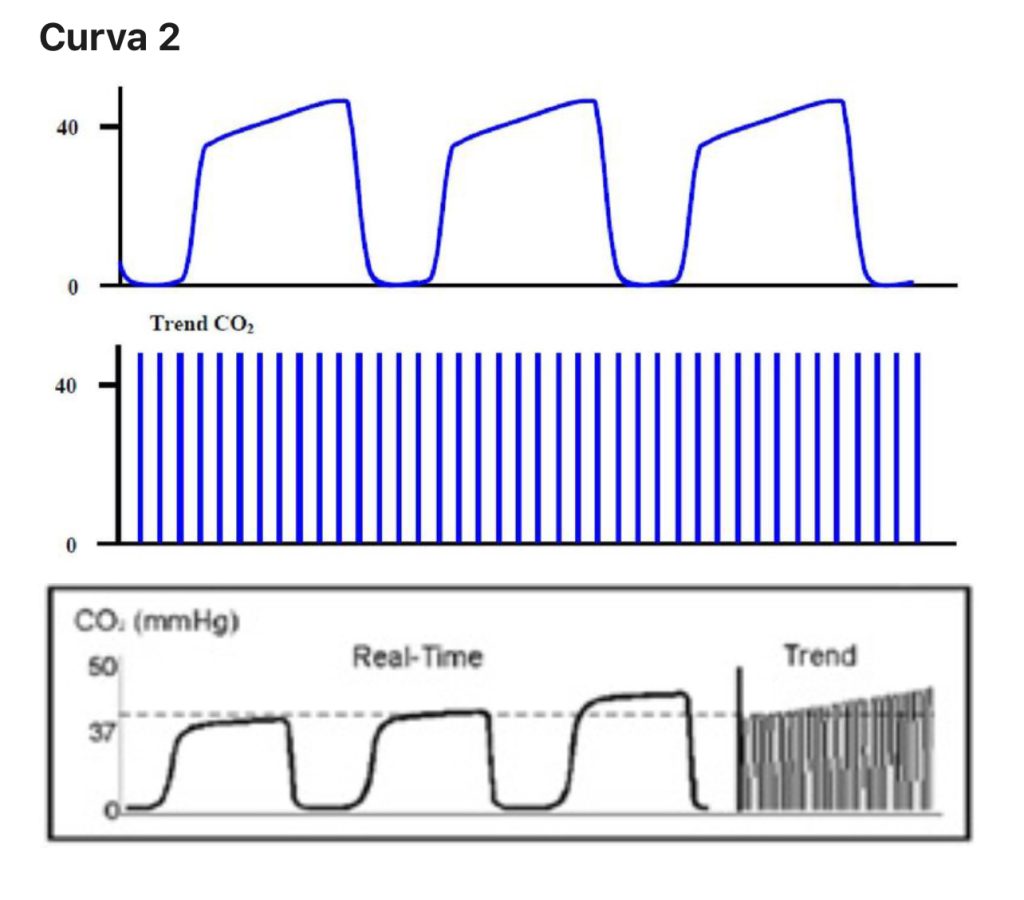 L’importanza del monitoraggio capnografico nella ventilazione meccanica: approfondimento tecnico 10