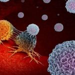 I progressi nella lotta al cancro e l'emergente sfida del tumore al colon nei giovani