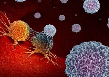 I progressi nella lotta al cancro e l'emergente sfida del tumore al colon nei giovani