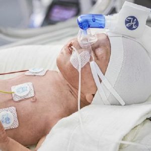 Le Bubble CPAP (bCPAP) nei pazienti pediatrici: indicazioni e management infermieristico
