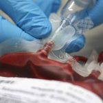 Gli errori nelle emotrasfusioni di ieri e oggi