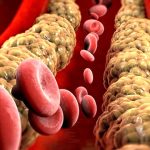 Il gene Pcsk9 nel mirino degli scienziati contro l'ipercolesterolemia