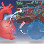Innovazione nel trattamento dell’infarto miocardico: gli idrogel iniettabili promettono una rivoluzione