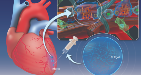 Innovazione nel trattamento dell’infarto miocardico: gli idrogel iniettabili promettono una rivoluzione