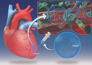Innovazione nel trattamento dell’infarto miocardico: gli idrogel iniettabili promettono una rivoluzione