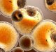 Grasso bruno, scoperta una proteina "interruttore" che lo spegne e favorisce l'obesità