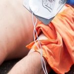 Innovazioni nel trattamento dell'arresto cardiaco: prospettive sulla doppia defibrillazione