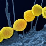 Streptococcus pyogenes, detto "mangiacarne": una minaccia batterica in crescita