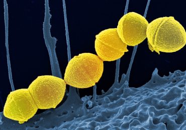 Streptococcus pyogenes, detto "mangiacarne": una minaccia batterica in crescita