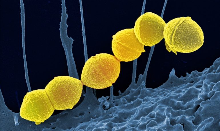 Streptococcus pyogenes, detto "mangiacarne": una minaccia batterica in crescita