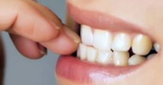Denti: allo studio farmaco che li fa ricrescere